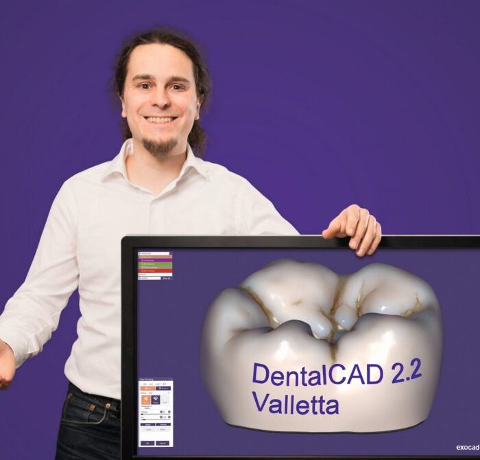 ExoCad patch 2.2 Valletta crack 2020