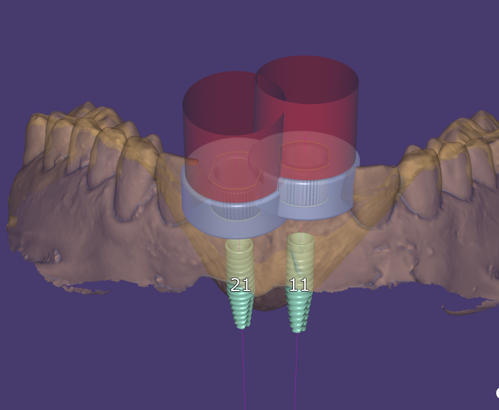exocad dentalСAD crack