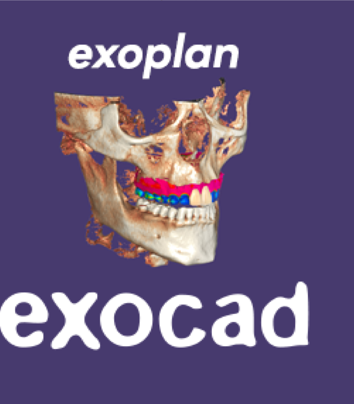 Exoplan crack