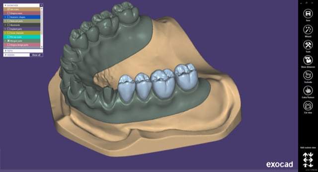 Exocad patch 2.4 Plovdiv 2020 crack
