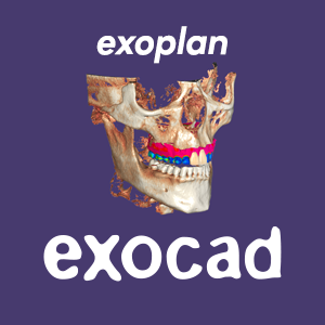 Exoplan patch 3.0 Galway crack