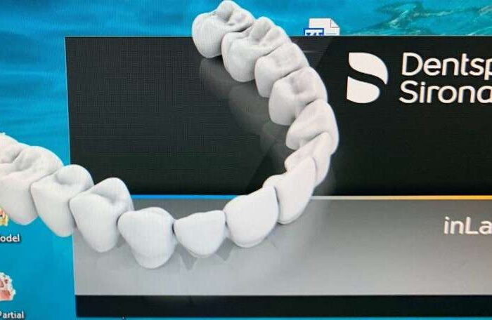 InLab CAD SW patch 20 crack 2020