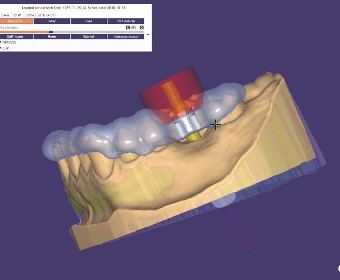 Exoplan patch 2.3 Matera