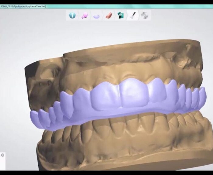 3shape dental system crack