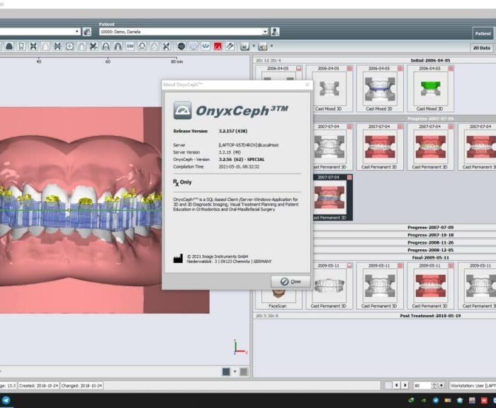 OnyxCeph 2021 crack full modules interface screen