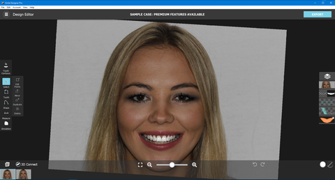 Smile design pro 3.3.1 full crack